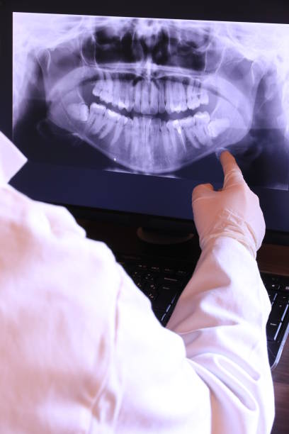 Best Emergency Tooth Extraction in Cartersville, GA