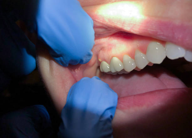 Best Same-Day Emergency Dentist in Cartersville, GA