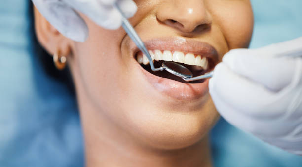 Best Emergency Dental Surgery in Cartersville, GA