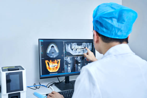 Best Emergency Wisdom Teeth Removal in Cartersville, GA
